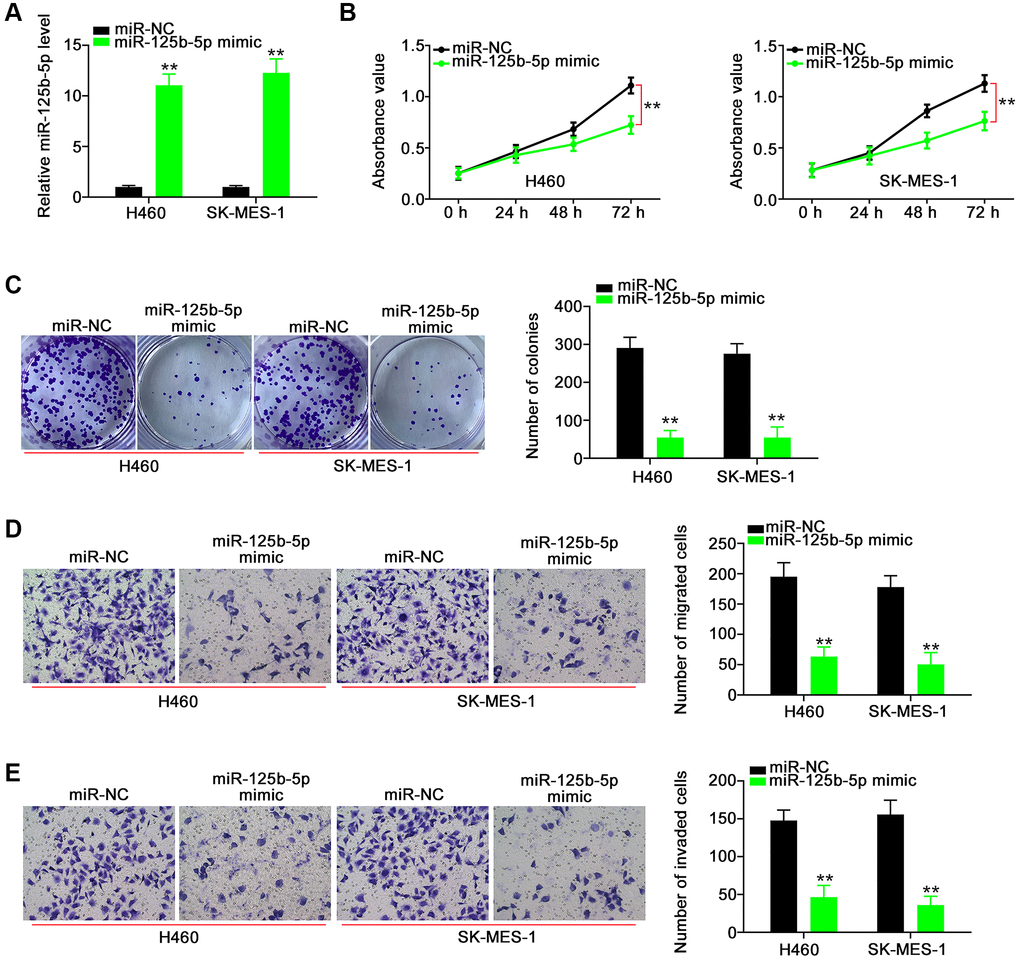 miR-125b-5p exerts anti-tumor actions in NSCLC cells. (A) The efficiency of miR-125b-5p mimic in NSCLC cells. **P B and C) The proliferation and colony-forming of NSCLC cells after miR-125b-5p overexpression. **P D and E) The motility of NSCLC cells after being transfected with miR-NC or miR-125b-5p mimic. **P 