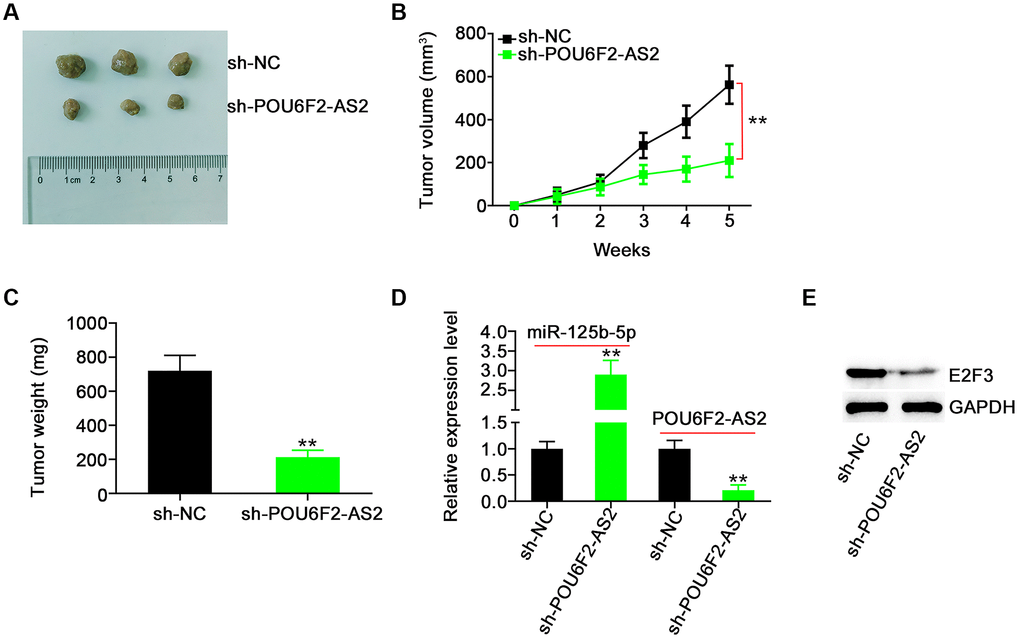POU6F2-AS2 downregulation represses tumor growth in vivo. (A) The representative image of xenografted tumor tissues. (B and C) The growth curves and weight of xenografted tumor tissues. **P D) miR-125b-5p and POU6F2-AS2 levels in xenografted tumor tissues. **P E) E2F3 protein level in xenografted tumor tissues. **P 