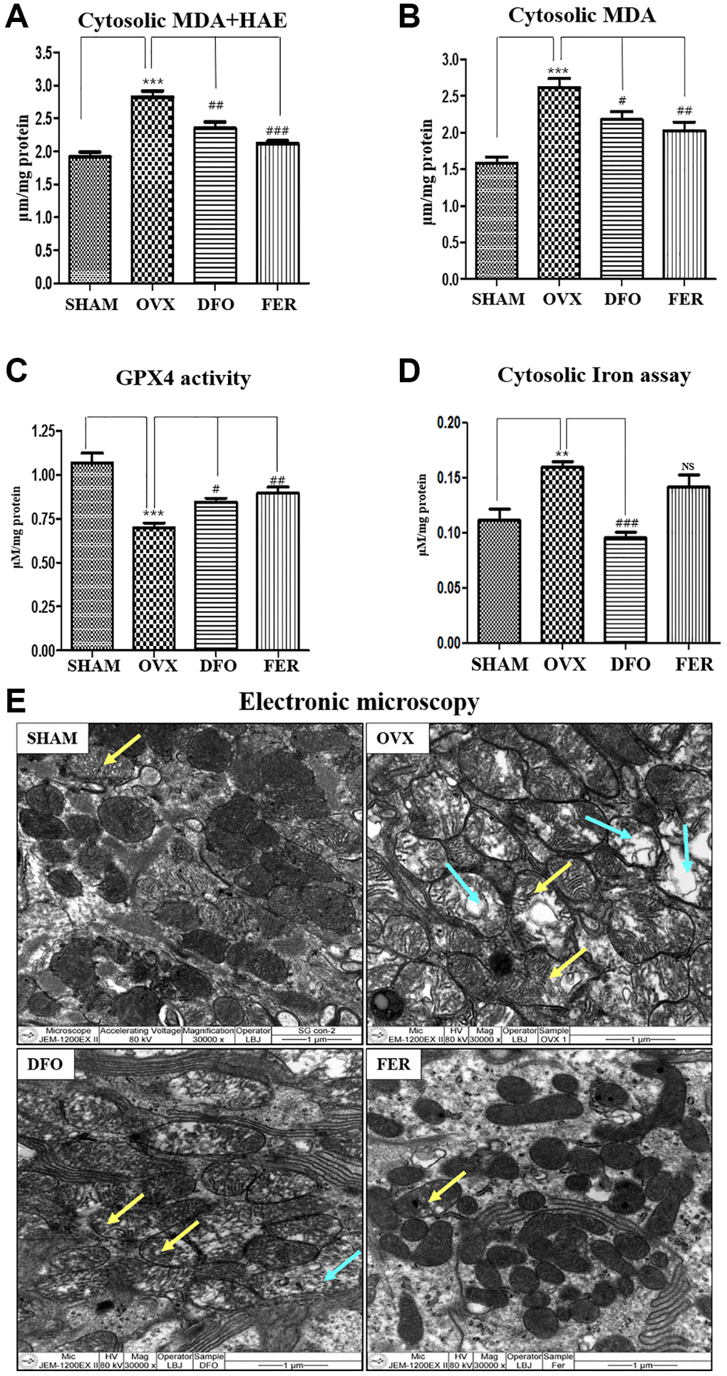 Inhibitory effect on ferroptosis. Cytosolic MDA (A) and cytosolic MDA + HNE (B) concentrations in the submandibular gland tissue. Compared to the SHAM group, the cytosolic MDA and MDA + HAE concentrations in the submandibular gland increased in the OVX group (p p p p p Figure 3A and 3B). (C) GPX4 activity. GPX4 activity was reduced in the OVX group (p p P D) Cytosolic iron content. Compared to the SHAM group, the cytosolic iron level increased in the OVX group and significantly decreased in the DFO group. (E) Electron microscopy images of mitochondria in the submandibular gland. The yellow arrow for indicating mitochondrial swelling, and blue arrow for indicating mitochondrial degeneration In the SHAM group, there was clear condensation of mitochondria and the shape was normal, but in the OVX group, the shape was irregular and the integrity was decreased. In the DFO and FER groups, mitochondrial recovery could be confirmed morphologically. Two-way ANOVA was performed. **p ***p #p ##p ###p 