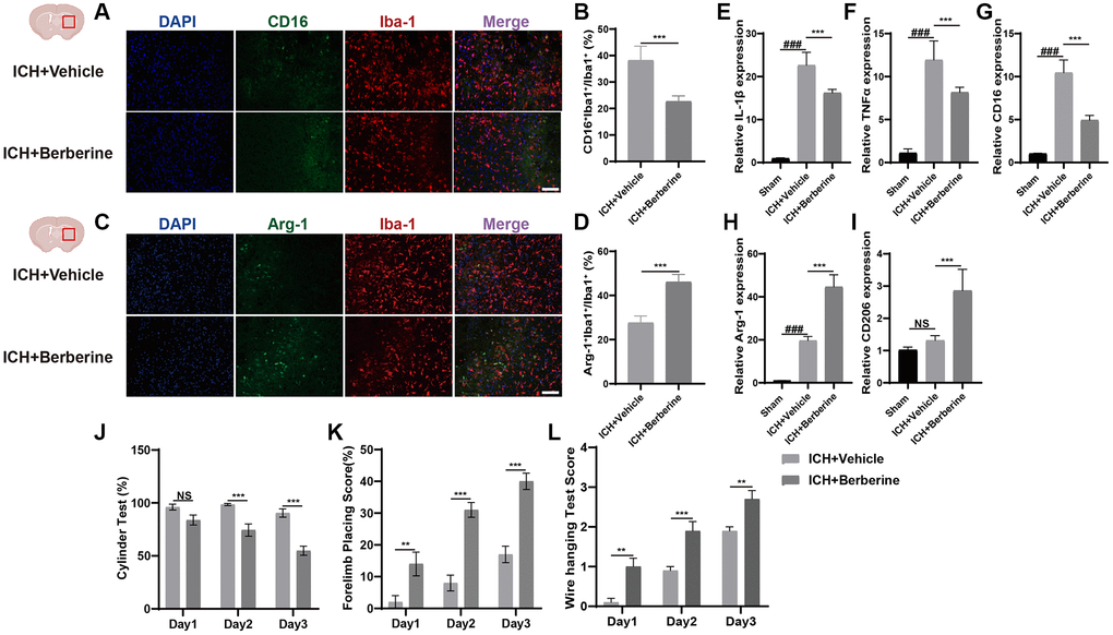 Berberine promoted the phenotype of microglia/macrophage transformed into anti-inflammation and ameliorated ICH-induced brain injury and improves neurological function. (A, B) Immunostaining for CD16+Iba-1+/Iba-1+ in ICH + Vehicle and ICH + Ber group after ICH day 3. (n = 5 per group). (C, D) Immunostaining for Arg-1+Iba-1+/Iba-1+ in ICH + Vehicle and ICH + Ber group after ICH day 3. (n = 5 per group). (E–G) The levels of mRNA transcription of IL-1β, TNF-α, and CD16 were examined by qRT-PCR in sham, ICH + Vehicle, and ICH + Ber groups after ICH day 3. (n = 6 per group). (H, I) Relative mRNA expression of Arg-1 and CD206 in sham, ICH + Vehicle, and ICH + Ber groups after ICH day 3. (n = 6 per group). (J–L) The percentage of cylinder test, forelimb test, and the score of wire hanging test in ICH + Vehicle and ICH + Ber group. (n = 10 per group). Data are expressed as the mean ± SEM. #P ##P ###P *P **P ***P 