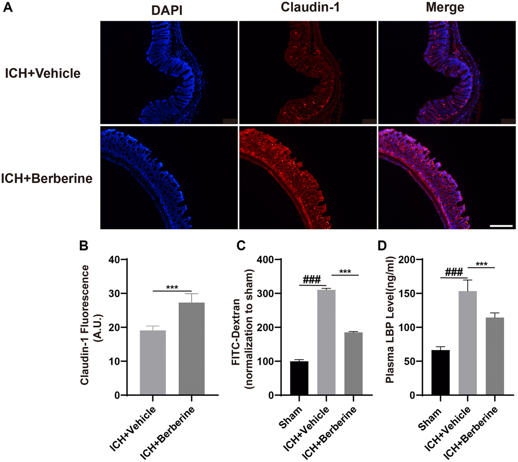 Effect of berberine on gut permeability and gut intestinal integrity after ICH. (A) The representative image of immunofluorescence staining of the tight junction protein Claudin-1 in ICH + Vehicle and ICH + Ber at day 3. (n = 5 per group). (B) The mean of densities of Claudin-1 after ICH day 3. (C) Ber treatment improved the intestinal permeability after ICH day 3. (n = 5 per group). (D) The level of LBP in plasma after Ber treatment day 3 in ICH mice. (n = 5 per group). Data are expressed as the mean ± SEM. #P ##P ###P *P **P ***P 