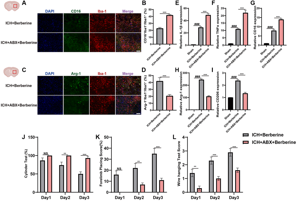 Berberine ameliorated ICH-induced neuroinflammation and brain injury after ICH in gut microbiota-dependent manner. (A, B) Before ICH, the mice were received the broad-spectrum ABX treatment for 4 weeks. Immunostaining for CD16+Iba-1+/ Iba-1+ in ICH + Vehicle + Ber and ICH + ABX + Ber group after ICH day 3. (n = 5 per group). (C, D) Immunostaining for Arg1+Iba-1+/Iba-1+ in ICH + Vehicle + Ber and ICH + ABX + Ber group after ICH day 3. (n = 5 per group). (E–G) qRT-PCR examined the levels of mRNA transcription of IL-1β, TNF-α, and CD16 in ICH + Vehicle + Ber and ICH + ABX + Ber group after ICH day 3. (n = 6 per group). (H, I) qRT-PCR examined the levels of mRNA transcription of Arg-1 and CD206 in ICH + Vehicle + Ber and ICH + ABX + Ber group after ICH day 3. (n = 6 per group). (J–L) Cylinder test, forelimb place test, and the wire hanging test in ICH + Vehicle + Ber and ICH + ABX + Ber group after ICH day 3. (n = 10 per group). Data are expressed as the mean ± SEM. #P ##P ###P *P **P ***P 