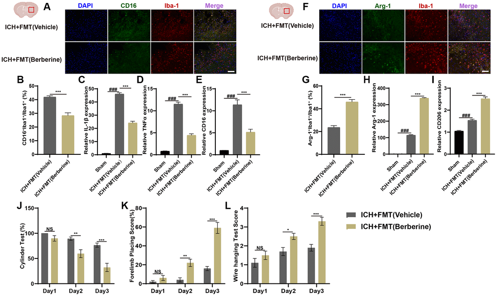 Transplantation of fecal microbiome from berberine treatment ICH mice alleviates neuroinflammation via regulating microglia/macrophage phenotype and improves the neurobehavioral function after ICH. (A, B) Immunostaining for CD16+Iba-1+/Iba-1+ in ICH +FMT (Vehicle) and ICH + FMT (Ber) group after ICH day 3. (n = 5 per group). (C–E) Relative mRNA expression of IL-1β, TNF-α, and CD16 in ICH + FMT (Vehicle) and ICH + FMT (Ber) groups after ICH day 3. (n = 6 per group). (F, G) Immunostaining for Arg-1+Iba-1+/ Iba-1+ in ICH + FMT (Vehicle) and ICH + FMT (Ber) group after ICH day 3. (n = 5 per group). (H, I) Relative mRNA expression of Arg-1 and CD206 in ICH + FMT (Vehicle) and ICH + FMT (Ber) groups after ICH day 3. (n = 6 per group). (J–L) Transplanted ICH mice with the fecal microbiome obtained from Ber treatment ICH donors improved the neurological function as assessed by the cylinder test, forelimb placing test, and wire hanging test after FMT (n = 10 per group). Data are expressed as the mean ± SEM. #P ##P ###P *P **P ***P 