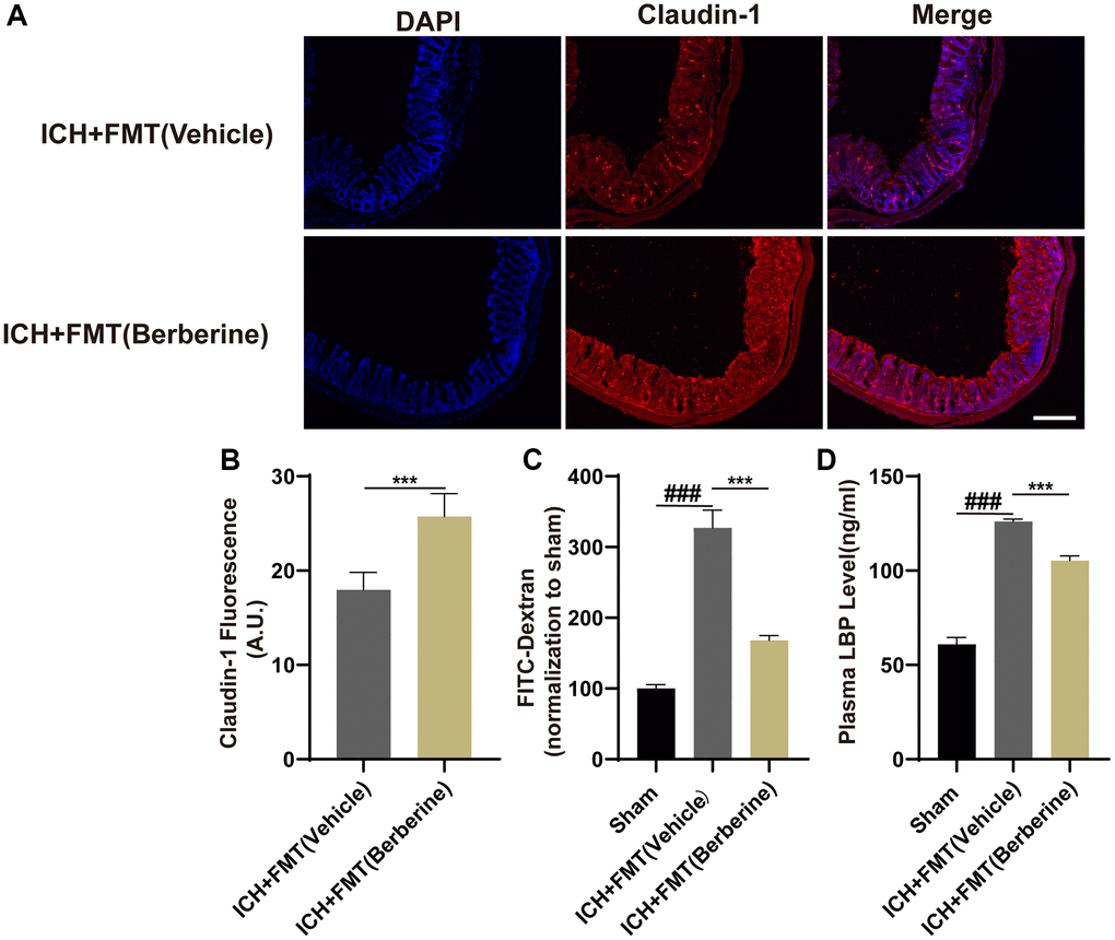 Transplantation of fecal microbiome from Ber treatment ICH mice improves the gut function. (A) The representative image of immunofluorescence staining of the tight junction protein Claudin-1 in ICH + FMT (Vehicle) and ICH + FMT (Ber) at day 3. (B) The mean of densities of Claudin-1 after ICH day 3. (n = 5 per group). (C) FMT treatment improved the intestinal permeability after ICH day 3. (n = 5 per group). (D) The level of LBP in plasma after FMT treatment after ICH day 3. (n = 5 per group). Data are expressed as the mean ± SEM. #P ##P ###P P **P ***P 