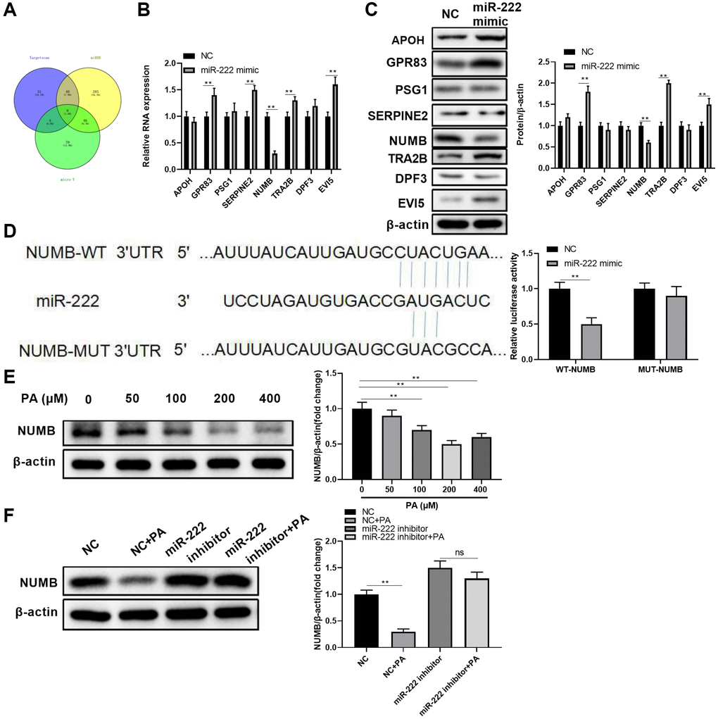 NUMB is a direct miR-222 target in human retinal pigment epithelial cells. (A) A Venn diagram shows the numbers of candidate miR-222 mRNA targets predicted by three public algorithms: TargetScan, miRDB, and micro-T. (B) The mRNA and (C) protein levels of the indicated candidates in ARPE-19 cells were determined 48 h after transfection of control (NC) or miR-222 mimics. (D) Diagrams show the putative miR-222 binding sites and corresponding wild type (WT) or mutant (MUT) sites of NUMB 3’UTR. The luciferase activity was detected in ARPE-19 cells at 48 h after co-transfection of WT or MUT NUMB 3’UTR together with negative control (NC) or miR-222 mimics. (E) NUMB protein levels in ARPE-19 cells treated with palmitic acid at the indicated concentrations. (F) ARPE-19 cells were transfected with negative control or miR-222 mimics, and 48 h later cells were left untreated or treated with 200 μM palmitic acid for another 48 h. NUMB protein levels in each group were determined by western blot. For all western blot data, representative bands images are shown, and the relative protein levels were summarized from three independent experiments with similar results. n = 3 for each group; *P **P 