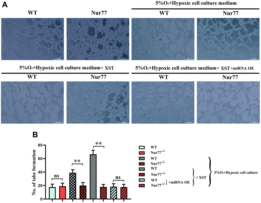 XST inhibits miR-3158-3p targeting Nur77 and regulates the proliferative capacity of blood vessels. (A) The tube forms a plot of experimental results. (B) Tube formation experiment data statistics.