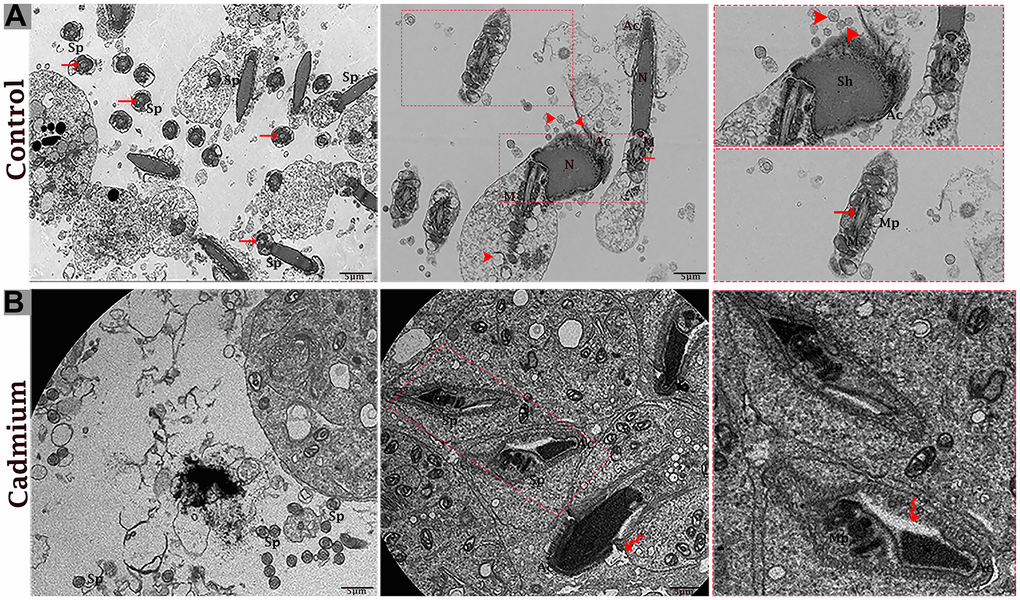 Electron micrograph of spermatozoa of control (A) and cadmium treated (B) group. (A) Healthy spermatozoa were observed in luminal compartment of seminiferous tubules. (B) Destructive spermatozoa were observed in luminal compartment of seminiferous tubules. Sp: spermatozoa; Sh: sperm head; Mp: mid-peace; N: nucleus; Ac: acrosome reaction; M: mitochondria; (arrow head) exosome; (arrow) axonema; (curved arrow) vacuolation. Scale bars 5 μm.