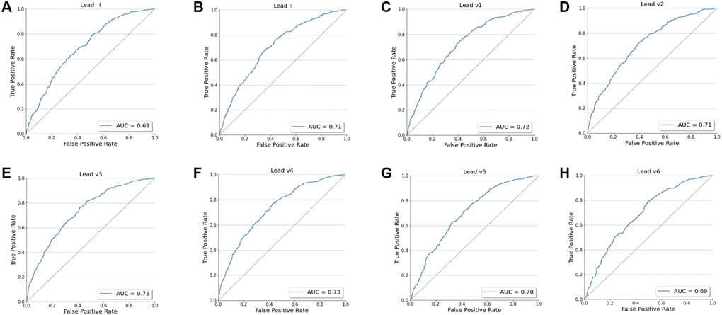 The ROC curve for the model's screening performance on the test dataset using every single lead (I, II, V1-V6). (A) The ROC curve for I lead. (B) The ROC curve for II lead. (C) The ROC curve for V1 lead. (D) The ROC curve for V2 lead. (E) The ROC curve for V3 lead. (F) The ROC curve for V4 lead. (G) The ROC curve for V5 lead. (H) The ROC curve for V6 lead.