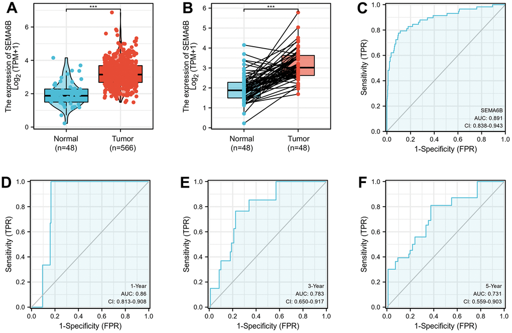 (A) RNA sequencing data analysis on SEMA6B mRNA expression differences between normal and thyroid cancer (THCA) tissues. (B) RNA sequencing validation on SEMA6B mRNA expression in paired samples of THCA and normal thyroid tissues. Data were retrieved from publicly available online platform GTEx (C–F) ROC curve for SEMA6B in THCA samples.