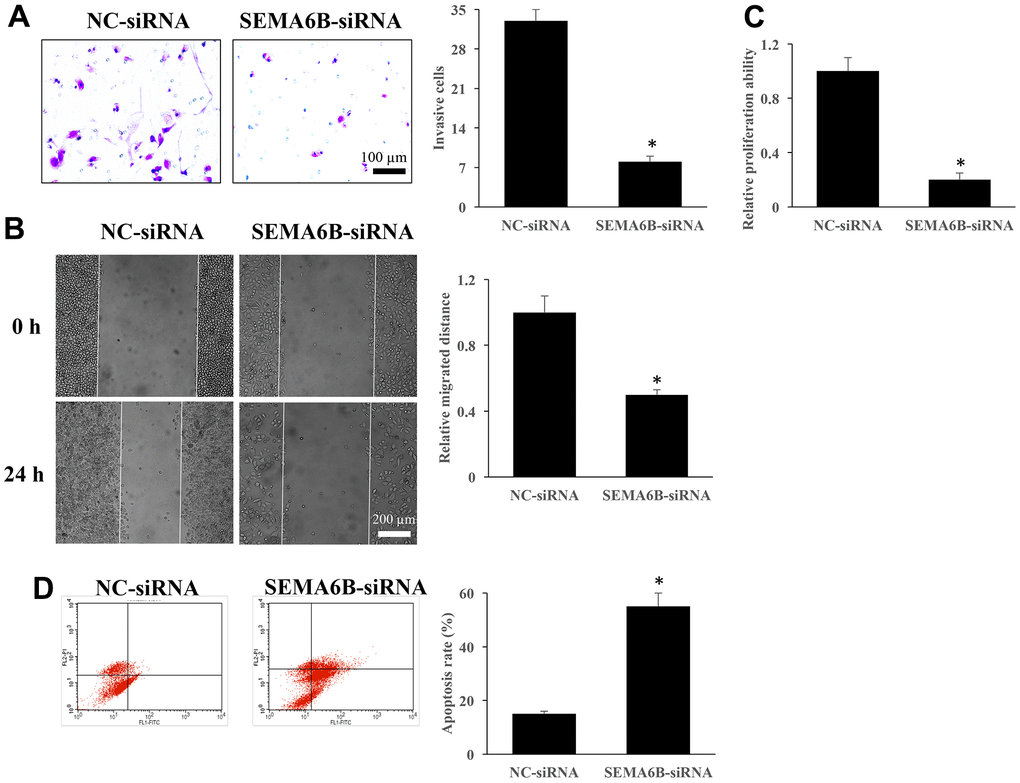 Knockdown of SEMA6B inhibited the cell proliferation, migration, invasion of thyroid cancer cells, but promoted apoptosis. The influence of SEMA6B on thyroid cancer cells invasion (A). The influence of SEMA6B on thyroid cancer cells migration (B). The influence of SEMA6B on thyroid cancer cells proliferation (C). The influence of SEMA6B on thyroid cancer cells apoptosis (D). *