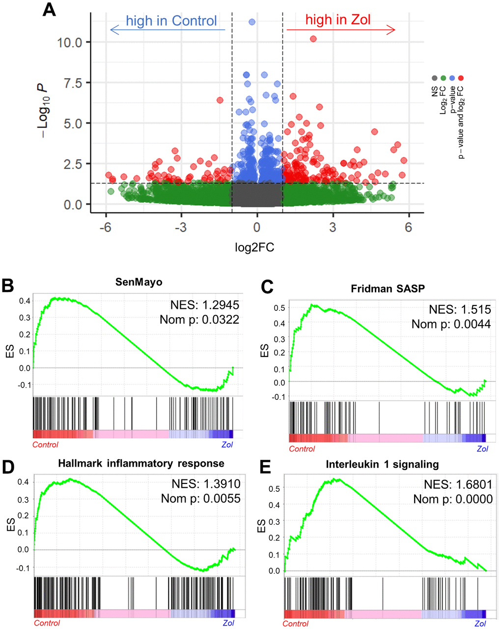 In silico analysis indicates the senolytic/senomorphic activity of zoledronic acid. (A) Volcano plot showing the differentially regulated genes between control and zoledronic acid treatments. (B) The SenMayo and (C) Fridman senescene/SASP gene sets indicate a downregulation of senescence-associated pathways in the zoledronic acid group, and (D) the hallmark of inflammatory response as well as (E) Interleukin 1 signaling also indicate a lower inflammatory activity in the zoledronic acid group. p-values are using one-way ANOVA with multiple comparisons, adjusted with the Tukey post-hoc method. N=8 mice in the Control and n=7 in the zoledronic acid group.