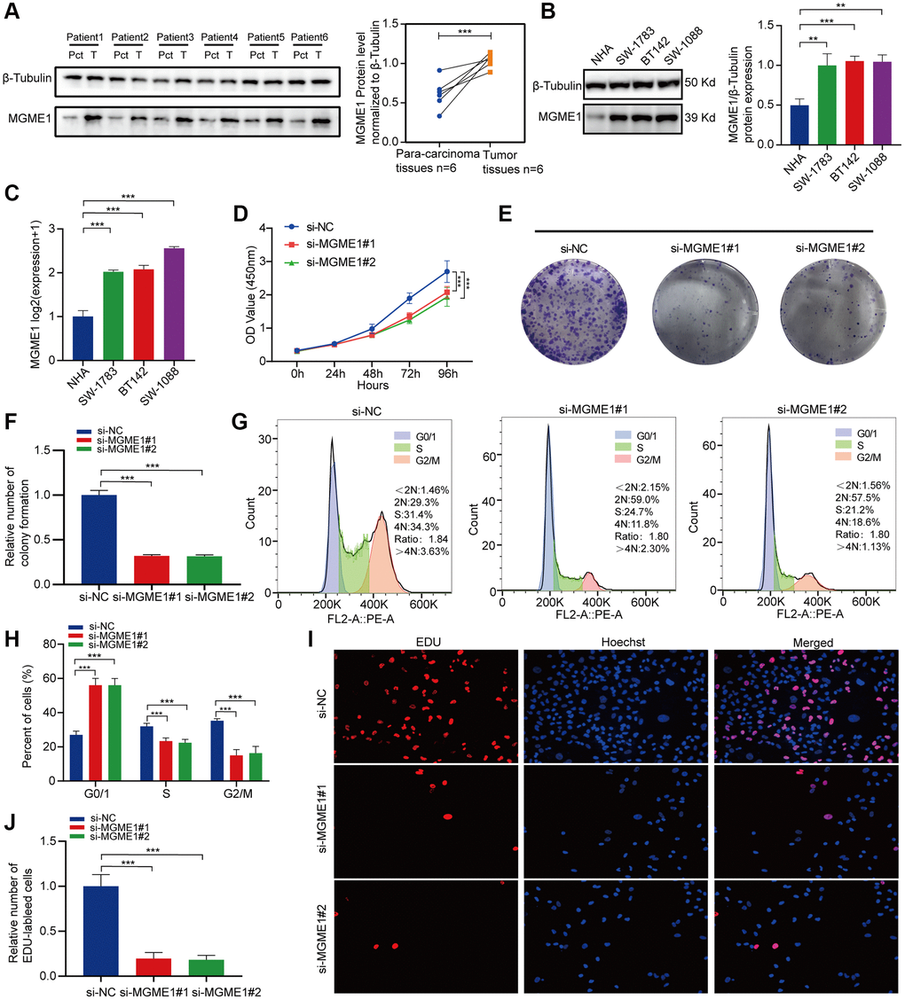 In vitro experimental verification of MGME1 in LGG. (A) Western blot analysis of MGME1 expression in LGG tissues and corresponding para-carcinoma tissues. (B) Western blot and (C) qRT-PCR analysis of MGME1 expression in NHA and LGG cell lines. (D) The cell viability of si-MGME1-transfected and si-NC-transfected SW1088 cells by CCK-8 assays. (E, F) Effect of MGME1 knockdown on colony formation was counted in SW1088 cells. (G, H) Cell cycle assays were executed to assess the cell cycle distribution of the SW1088 cells transfected with si-MGME1 or si-NC lentiviruses. (I, J) Representative images (I) and histogram analysis (J) of EdU assays after silencing MGME1 in SW1088 cells.