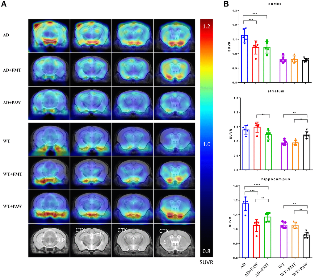 Radioactivity uptake assay of fecal microbiota transplantation (FMT) and plasmon-activated water (PAW)-fed AD mice. (A) 18F-Florbetapir animal positron emission tomographic (PET) images were generated from 16-month-old wild-type (WT), WT fed PAW and FMT WT, AD, PAW-fed AD, and FMT AD mice. The color bar of the right line shows the standardized uptake value ratio (SUVR) compared to the cerebellum (SUVRcer). (B) Comparison of relative 18F-florbetapir uptake levels in the cortex, striatum, and hippocampus of the brain. All results were analyzed by ANOVA with a post hoc analysis. (*p **p ***p 