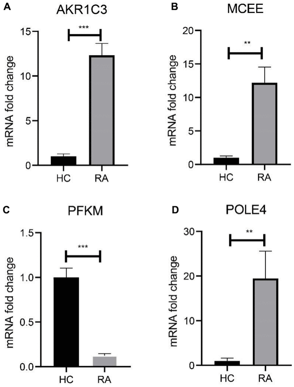 Validation of 4 diagnostic feature biomarkers in clinical tissues via qRT-PCR. The expression of (A) AKR1C3, (B) MCEE, (C) PFKM and (D) POLE4. Statistical significance: *P 