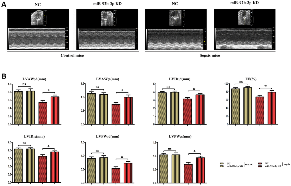 The changes of cardiac function in mice were detected by ultrasound. (A) Echocardiogram of the mouse heart. (B) Changes of echocardiographic parameters in mice. *p 