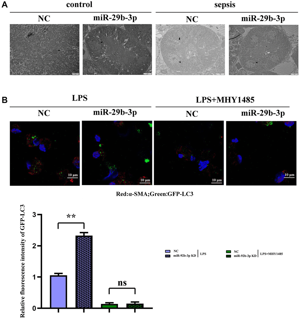 Observation of myocardial autophagy in mice via electron microscopy and detection of GFP-LC3 puncta formation via fluorescence microscopy. (A) Control group and the sepsis group used electron microscopy to observe the autophagy result plot; (B) Fluorescence plot of GFP-LC3 spots in each group and expression of relative fluorescence intensity. **p p > 0.05.