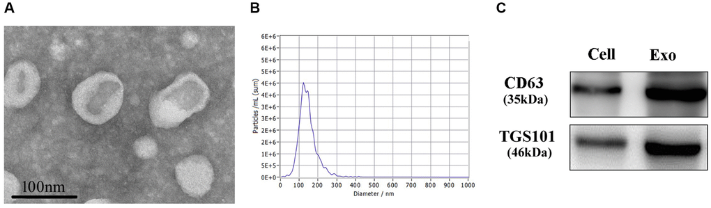 Identification of exosomes. (A) The morphologies of exosomes were observed through an electron microscope. (B) NTA was used for the size determination of exosomes. (C) Western Blot was used to measure CD63 and TSG101 proteins.