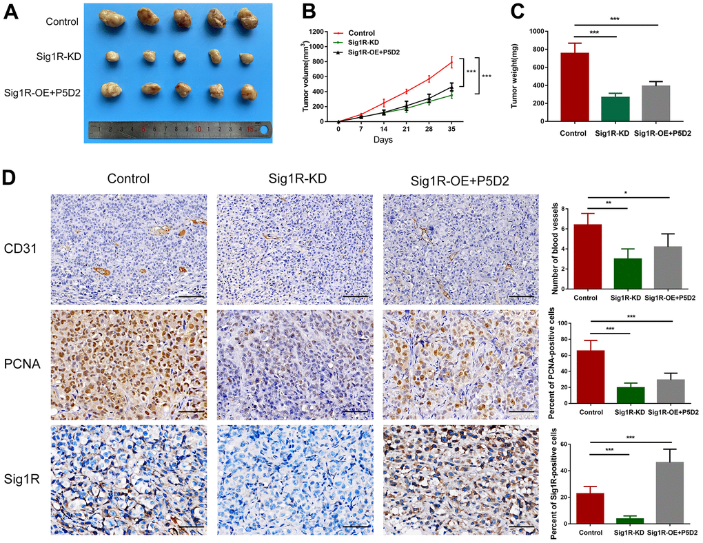 Sig1R mediates BEM-induced BC cell proliferation in vivo. (A) Xenograft model in nude mice. (B) Tumor growth curve of Sig1R-KD, Sig1R-KD, or Sig1R-KD T24 cell BC subcutaneous xenograft tumor. (C) The weight of dissected xenograft tumors in each group was assayed. (D) The IHC staining was performed to detect the expression levels of Sig1R, CD31, and PCNA, in harvested tumor tissues. *p 