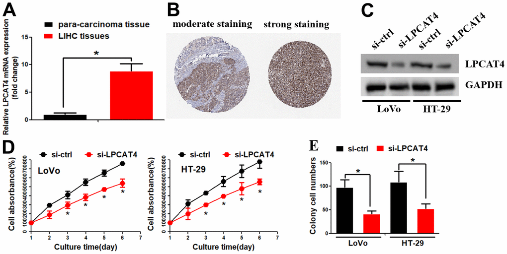 Identification of LPCAT4 biological function in LIHC. (A) LPCAT4 mRNA expression level was examined by RT-PCR assay. (B) LPCAT4 protein expression level in LIHC tissues. (C) Western blot assay was used to examine LPCAT4 protein down-regulation efficiency. (D) MTT assay was used to analyze cell growth. (E) Colony formation ability in LPCAT4 down-regulation and control group.