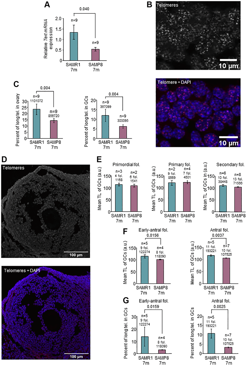 Analysis of Tert expression and telomere length in the ovary. (A) The graph shows mean mRNA expression of Tert normalized by Gapdh in the ovary of 7-month-old SAMP8 and SAMR1 females, measured by RT-qPCR. (B) The micrographs show representative images of telomere FISH on ovarian sections (white dots, left panel) and the merge (DAPI in blue and telomeres in red, right panel). (C) Percent of long telomeres in the ovary (left panel) and in GCs (right panel) in 7-month-old SAMP8 and SAMR1 females. (D) The micrographs show representative images of an antral follicle after telomere FISH (white dots, top panel) and the merge (DAPI in blue and telomeres in red, lower panel). (E) Mean TL, analyzed by FISH, of GCs of primordial, primary and secondary follicles in 7-month-old SAMP8 and SAMR1 females. (F) Mean TL, analyzed by FISH, of GCs of early-antral (left panel) and antral (right panel) follicles in 7-month-old SAMP8 and SAMR1 females. (G) Percent of long telomeres in GCs of early-antral (left panel) and antral follicles (right panel) in 7-month-old SAMP8 and SAMR1 females. n indicates the number of mice analyzed. Underneath the n or the number of follicles, the number of telomere spots is indicated. The S.E.M. is represented in error bars (A, C, E, F and G). Statistical significance was determined by unpaired t-test (E and F, right panels) and Mann-Whitney U test, for the rest of graphs. Scale bars are 10 μm (B) and 100 μm (D).