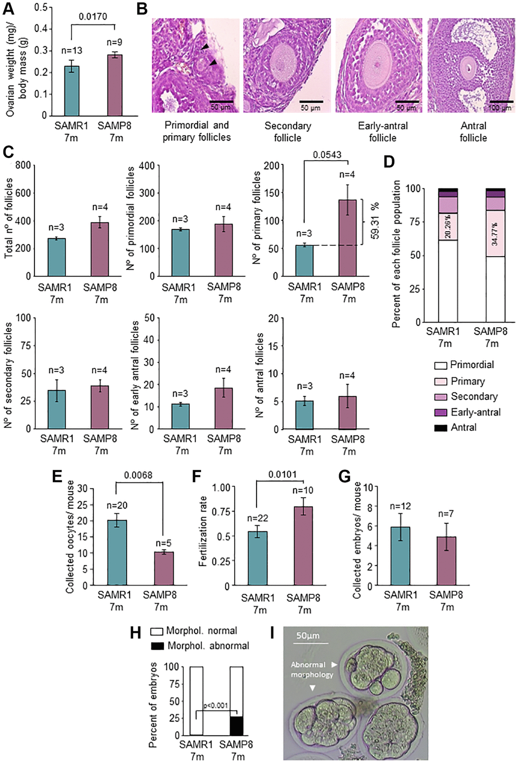 Characterization of ovarian function and fertility. (A) The graph shows the ratio of ovarian weight normalized to total body mass in 7-month-old SAMP8 and SAMR1 females. (B) Representative images of primordial, primary, secondary, early-antral, and antral follicles in H&E-stained ovarian sections. (C) Follicle count in H&E-stained ovarian sections in the mice described in A. The total number of follicles (left top panel), primordial (middle top panel), primary (right top panel), secondary (left lower panel), early-antral (middle lower panel) and antral follicles (right lower panel) are represented. (D) The graph shows follicle types in percentages in mice described in A. The percentages of primary follicles are indicated inside the corresponding box. (E) Mean number of collected oocytes after OS in mice described in A. (F) Fertilization rate in mice described in A. (G) Mean number of collected embryos after ovarian stimulation in mice described in A. (H) Percent of morphologically normal and abnormal embryos in mice described in A. (I) Representative images of preimplantation embryos (morphologically abnormal embryos are indicated with arrows). n indicates the number of mice analyzed. The S.E.M. is represented in error bars (A, C, E, F and G). Statistical significance was determined by Mann-Whitney U test (A, C, E and F) and unpaired t-test (G). Fisher’s exact test was used to determine p-values (H). Scale bars are 50 μm (B, left and middle panel) and 100 μm (B, right panel).