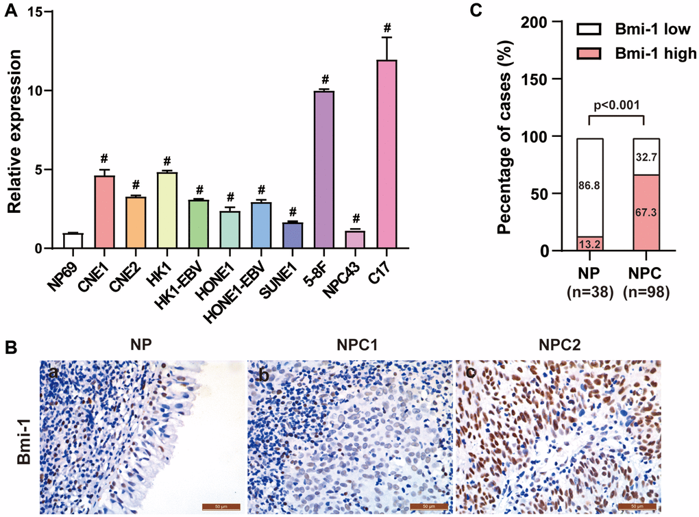 Bmi-1 was markedly upregulated in NPC clinical tissue specimens. (A) Bmi-1 levels were detected using qRT-PCR in the NPC cell lines shown. (B) Representative photographs from immunohistochemical analyses of Bmi-1 protein levels in NPC tissues and non-cancerous nasopharyngeal epithelial tissues. (C) Bmi-1 levels were significantly greater in NPC tissues than in non-cancerous nasopharyngeal epithelial tissues (P 2 test).