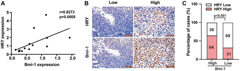 HRY levels correlated positively with Bmi-1 levels in NPC tissues. (A) HRY and Bmi-1 mRNA levels correlated significantly and positively with one another in NPC samples (Spearman’s correlation analysis, r = 0.8273, P = 0.0005). (B) Relationship between HRY and Bmi-1 levels in immunohistochemical analysis of NPC tissues. (C) HRY levels correlated positively with Bmi-1 levels in NPC tissues (χ2 test).