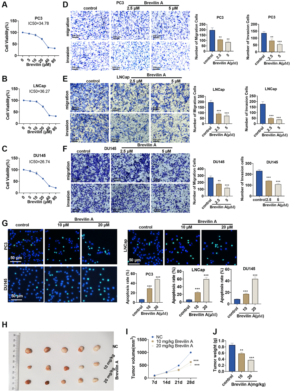 Brevilin A dampened prostate cancer cell proliferation. Brevilin A of different concentrations (0–80 μM) was adopted to treat prostate cancer cells (PC3, LNCap, DU145). (A–C) CCK8 assay examined cell viability. (D–F) Transwell checked cell migration and invasion. (G) TUNEL assay monitored apoptosis of PC3, LNCap, DU145 cells. (H) DU145 cells were taken to construct a nude mouse xenograft model of prostate cancer, and Brevilin A (10 mg/kg, 20 mg/kg) was administered for treatment. The tumors were excised 28 days later. (I, J) Tumor volume and tumor weight were calculated every 7 days. ns P > 0.05, *P **P ***P 