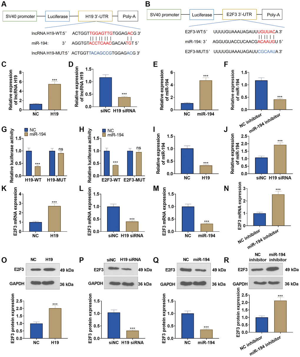 The interaction among lncRNA H19, miR-194, and E2F3. (A, B) Starbase database the binding site between lncRNA H19 and miR-194 as well as the binding site between miR-194 and E2F3. (C–F) qRT-PCR examined the profiles of lncRNA H19 and miR-194. (G, H) Dual luciferase reporter gene assay measured luciferase activity of DU145 cells. (I, J) The miR-194 level was probed via qRT-PCR. (K–R) Western blot and qRT-PCR tested the effects of lncRNA H19 and miR-194 on E2F3 expression. ns P > 0.05, ***P n = 3.