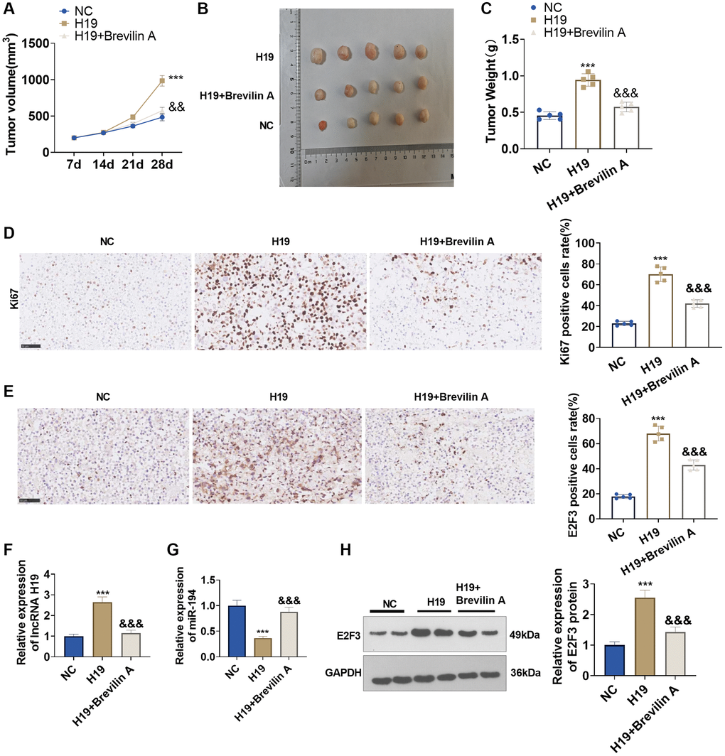 The functions of Brevilin A and lncRNA H19 in the prostate cancer nude mouse xenograft model. DU145 cells, stably transfected with lncRNA H19 overexpression plasmids, were taken to construct a nude mouse xenograft model of prostate cancer, and Brevilin A was harnessed for treatment. The tumors were excised 28 days later. (A) The tumor volume. (B) The images of tumors. (C) The tumor masses. (D, E) Immunohistochemistry determined Ki67 and E2F3 expressions. (F, G) qRT-PCR examined the profiles of lncRNA H19 and miR-194. (H) Western blot was used for examining E2F3 protein level. ***P &&P &&&P n = 5.