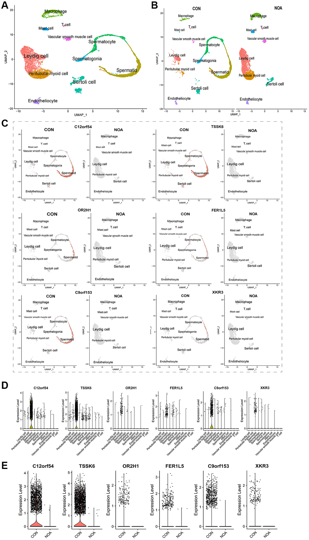 Single-cell maps define the cellular location of signature genes. (A) Overall UMAP of NOA versus control. (B) UMP distinguishing the origin. (C) UMAP of cellular localization of signature genes. (D) Violin plot of cellular localization of signature genes. (E) Violin plot of signature genes expression in NOA versus control. (P 