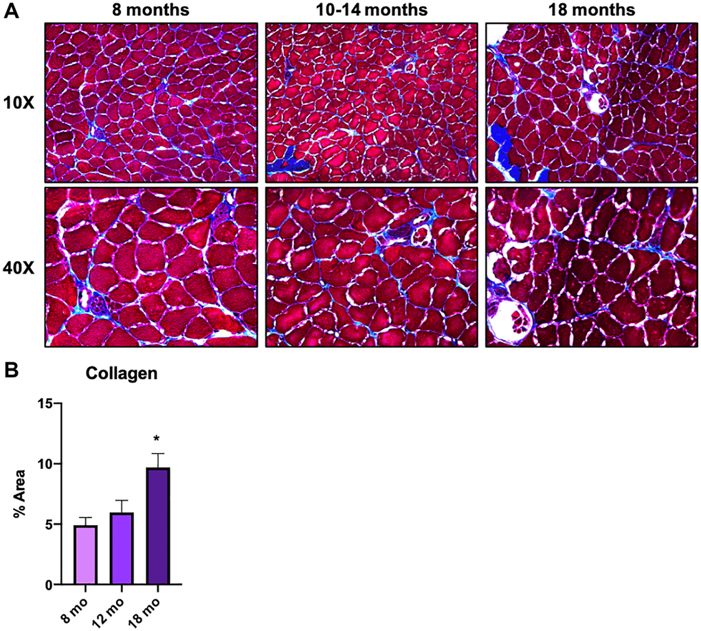 Macrophages in middle-aged skeletal muscle tissue are involved in ECM remodeling and contribute to the onset of skeletal muscle aging. (A) Gastrocnemius/soleus histologies with Masson Trichromic dye of 8 mo. old, 10-14 mo. old, and 18 mo. old mice. Both 10x and 40x magnification images are shown. (B) Bar graph shows the results of the quantification of collagen staining area in each age group. N = 3 Per group.