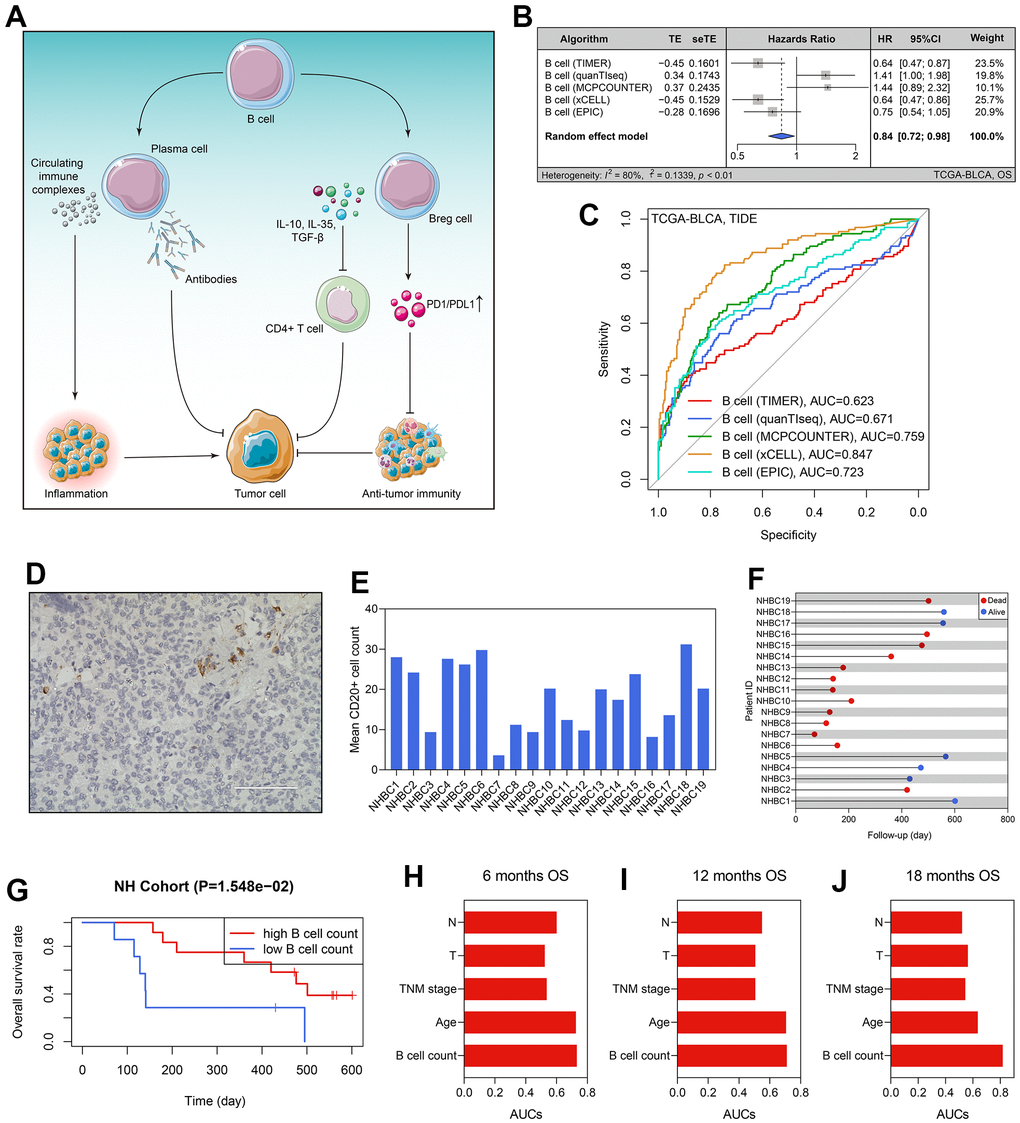 B cells’ prognosis value in BLCA. (A) The dual roles of B cells in tumor immunity. (B) The B cells’ infiltration level was a predictor for OS in the TCGA-BLCA cohort. (C) The predictive ability of B cells’ infiltrating proportion to immunotherapeutic sensitivity. (D) B cell number in each BLCA specimen was quantified using CD20 staining. (E) The B cell counts of the patients form the NH cohort. (F) The survival statuses and follow-up duration of the patients in the NH cohort. (G) High infiltration level of B cells heralded favorable prognosis in the NH cohort. (H–J) The comparison of the predictive ability of B cell number and routine clinicopathological traits to 6- (H), 12- (I), and 12-months’ OS (J). BLCA, bladder cancer; OS, overall survival.