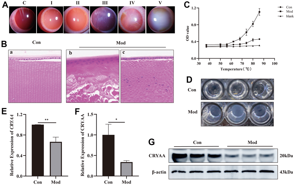 Experimental results of influence of naphthalene on rabbit lens. (A) Slit-lamp images of all grades of rabbit cataract; (B) The normal group (a) and model group (b, c) of rabbit lens HE staining (400x); (C) Statistical results of protein thermal stability experiment; (D) The picture of protein supernatant at 86° C; (E) Expression of CRYAA mRNA in rabbit lenses, **pF) Expression of CRYAA protein in rabbit lenses, *pG) The result of WB banding of CRYAA in rabbit lenses.