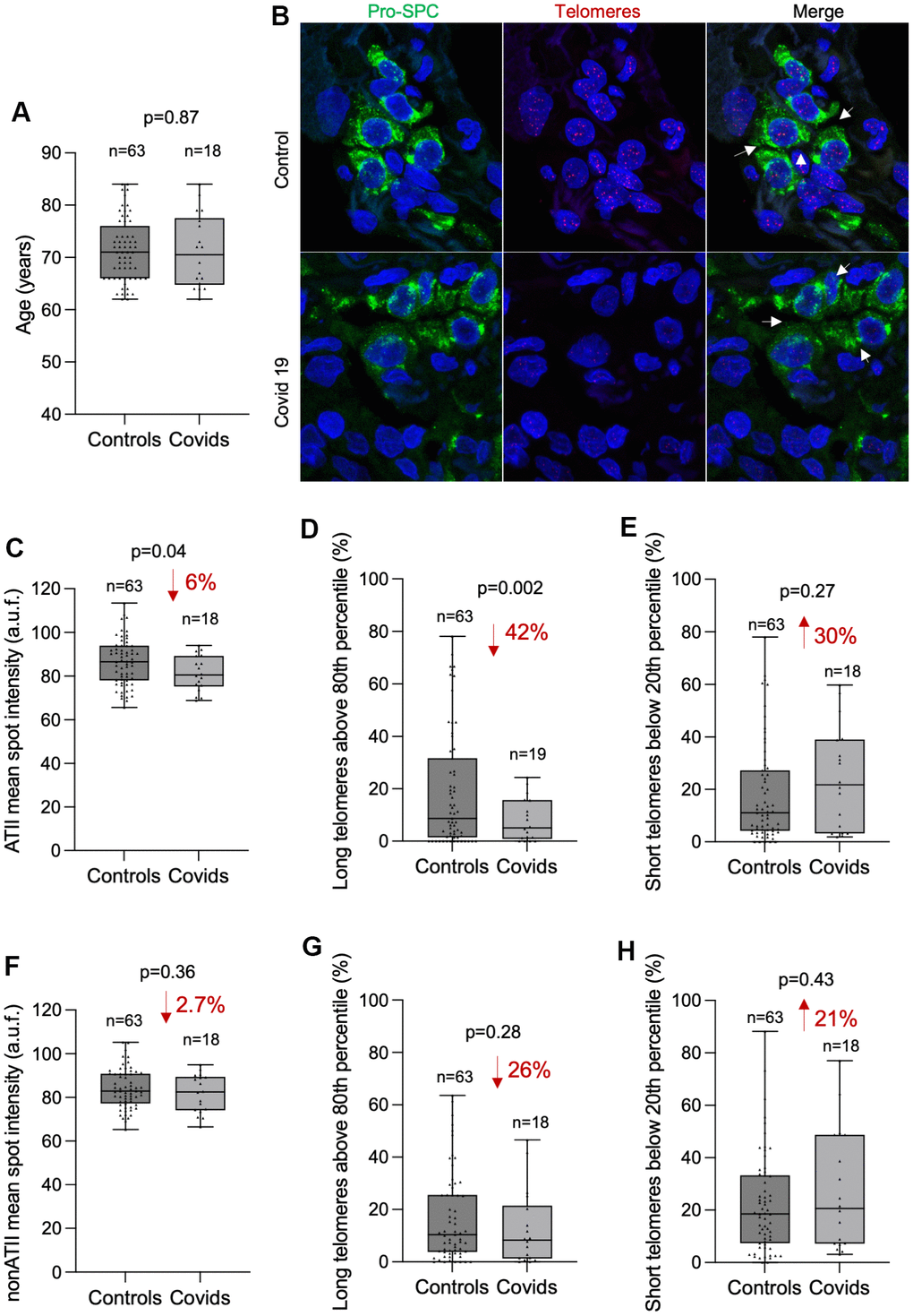 COVID-19 patients present shorter telomeres in the alveolar type II cells than controls. (A) Box and Whisker plot representation of control and COVID-19 patients’ age within 62 and 84 years old. Differences in age distributions between both control and COVID-19 sample groups was analyzed by Kolmogorov-Smirnov test. The p-value is indicated. (B) Representative images of telomere quantitative fluorescence in situ hybridization (q-FISH) combined with immunofluorescence against Pro-SPC in a control and a COVID-19 lung samples. (C–H) Box and Whisker plot representation of mean telomeric spot intensity per nucleus (C, F), percentage of long telomeres above 80th percentile (D, G) and percentage of short telomeres below 20th percentile (E, H) in alveolar type II (ATII) (C–E) and in non-ATII cells (F–H) in lung sections from control and COVID-19 patients within 62 and 84 year-old age interval. Statistical significance in (C–H) was assessed using unpaired Student’s t test with Welch’s correction and the p-value is indicated. The percent increase or decrease between control and COVID-19 samples are indicated in each plot.