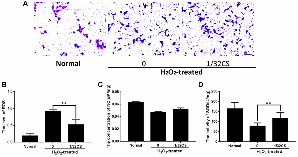 CS induces migration and inhibits oxidative stress of ADSCs. (A–D) The H2O2-treated ADSCs were treated with CS at the indicated doses. (A) The migration was tested by transwell assays in the cells. (B–D) The levels of ROS, NO, and SOD were examined by the corresponding measurement kit in the cells. Scal bar: 20 μm. Data are presented as mean ± SD. Statistic significant differences were indicated: *P **P 