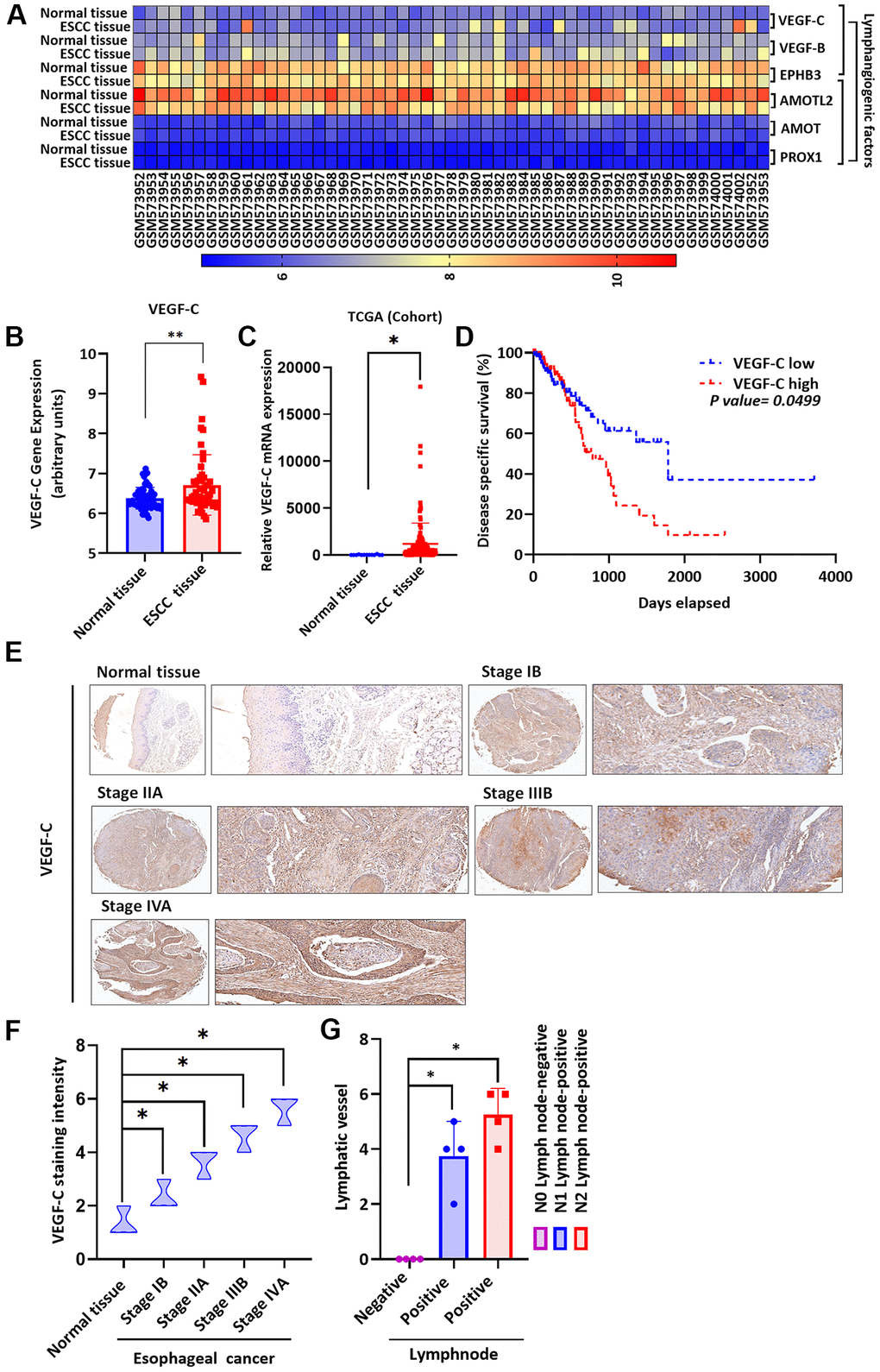 Clinicopathologic features of VEGF-C expression in human ESCC tissue. (A) The gene expression profiles of VEGF-C in ESCC tissue and normal tissue samples were analyzed in GEO and TCGA database records. (B, C) Levels of VEGF-C expression were significantly higher in ESCC samples compared with the normal tissue samples. (D) Kaplan-Meier analysis of overall survival according to VEGF-C expression in patients with esophageal cancer. (E, F) The human ESCC tissue array specimens were subjected to IHC evaluations with VEGF-C antibody, and the positive staining was quantified by IHC scoring (N = 4 per group). Scale bar: 100 μm. (G) Positive peritumoral lymphatic vessel density in patients with N0, N1, or N2 ESCC tissue array samples (N = 4 per group). *P 