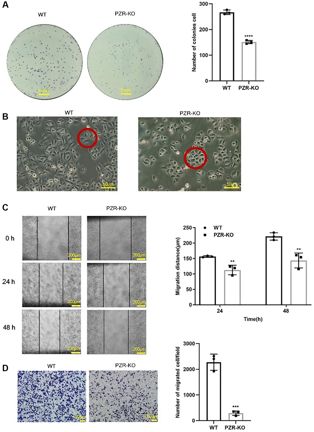 PZR-knockout SPC-A1 cells exhibit reduced proliferative, migrating, and invading ability. (A) Colonies formed by wild type and PZR-KO SPC-A1 cells were stained with crystal violet and then numerated. (B) Morphology of wild type and PZR-KO SPC-A1 cell (magnification, ×200). (C) Wound healing assays. Images show the wounded monolayers of wild type and PZR-KO SPC-A1 cells at 0 h, 24 h and 48 h (magnification, ×40). Black lines outline wound edges, and the distance between the lines was measured using the Image J software. The histogram shows migration distance after 24 h and 48 h. (D) Transwell invasion assays. Cells that passed through Matrigel and attached to the Transwell membrane were stained with crystal violet and numerated (magnification, ×100). All assays were done in triplicates. Data in bar graphs represent mean ± SD (n = 3). **P ***P 