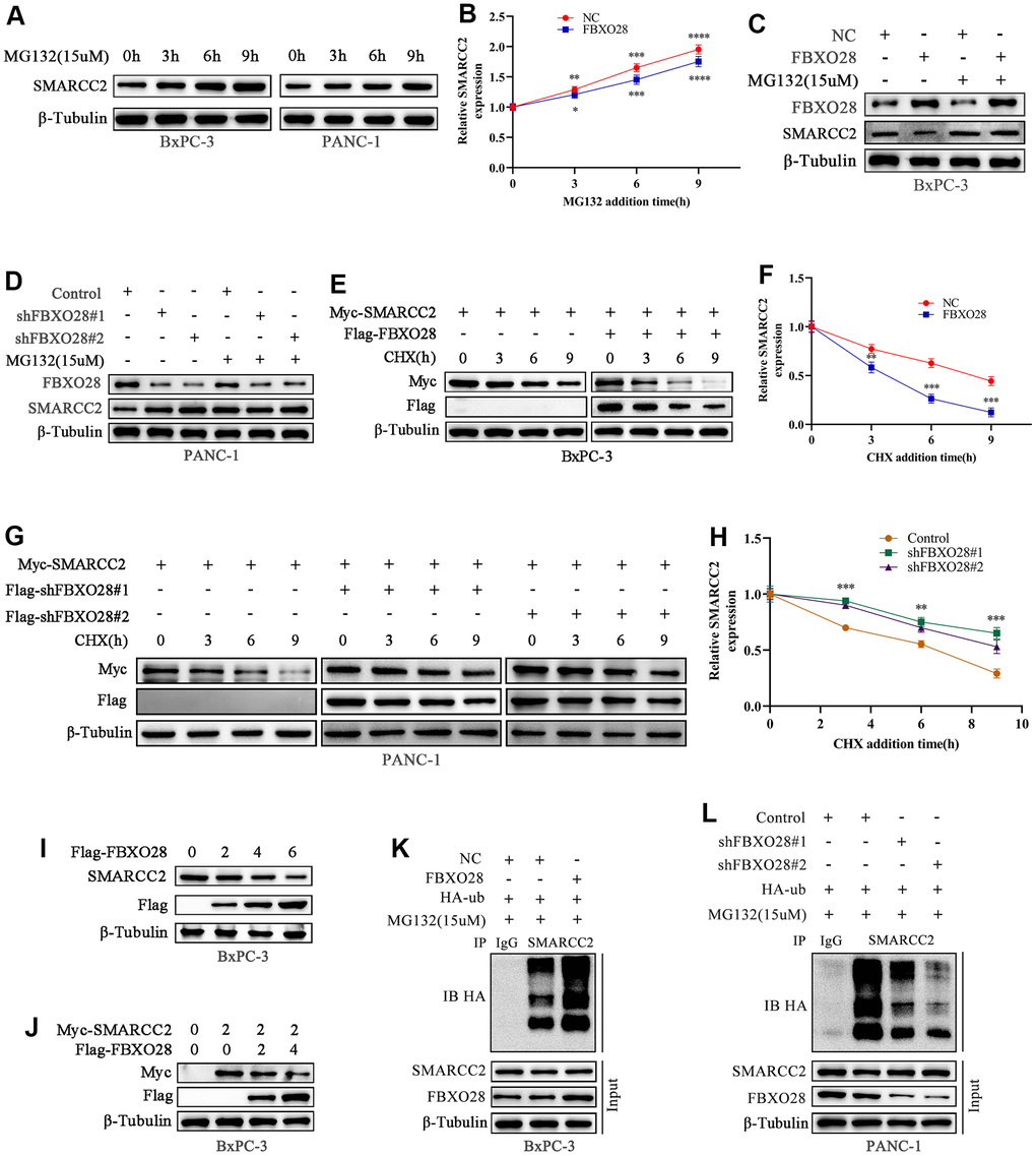 FBXO28 promotes SMARCC2 ubiquitination. (A, B) MG132 (15 μM) was applied to BxPC-3 and PANC-1 cells for the indicated times, and endogenous SMARCC2 levels were detected by western blot. (C, D) MG132 (15 μM) was added to overexpressing BxPC-3 cells and knockdown PANC-1 cells for the indicated times during the western blot to detect SMARCC2 changes. (E–H) CHX (20 μM) was applied to BxPC-3 and PANC-1 cells for the indicated times, and western blotting was carried out to detect SMARCC2 degradation. (I) BxPC-3 cells were transfected with incremental amounts of Flag-FBXO28 plasmid and detected with anti-SMARCC2 antibody to measure the endogenous SMARCC2 expression level. (J) BxPC-3 cells were transfected without treatment or with a single dose of the plasmid encoding Myc-SMARCC2, with or without co-transfection with the increased Flag-FBXO28 plasmid. SMARCC2 expression levels were detected with anti-Myc antibody. (K, L) Ubiquitin plasmid (HA-ub) plasmids were transfected in overexpressing BxPC-3 cells and knockdown PANC-1 cells, and SMARCC2 protein ubiquitination levels were detected by co-immunoprecipitation. *P 