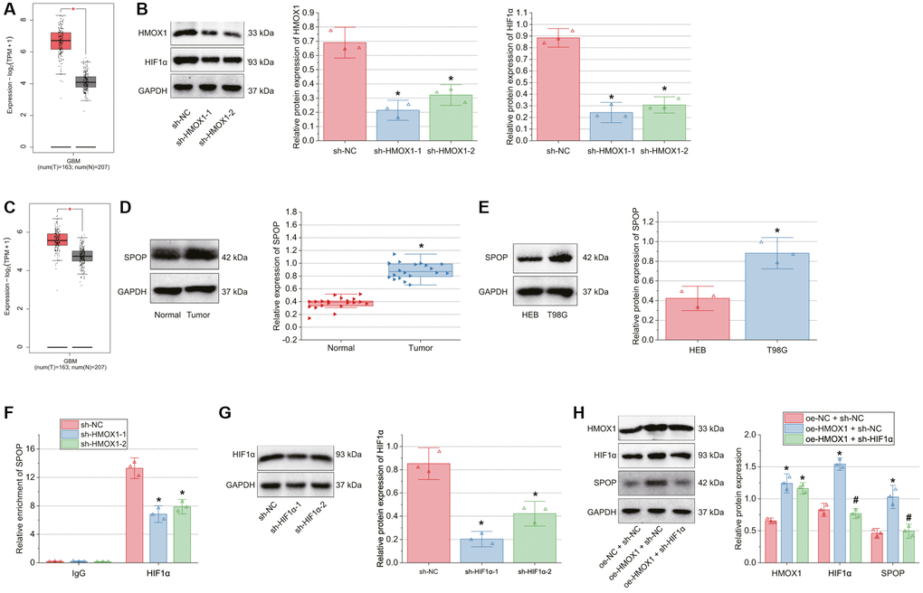 HMOX1 up-regulates SPOP expression by promoting HIF1α expression. (A) Expression of HIF1α in normal brain tissue samples and GBM tissue samples analyzed by the GEPIA database. The red box represents the GBM tissue samples (n = 163) and the gray box represents the normal brain tissue samples (n = 207). (B) Transfection efficiency of sh-HMOX1 in T98G cells determined by Western blot. (C) Expression of SPOP in normal brain tissue samples and GBM tissue samples analyzed by the GEPIA database. The red box represents the GBM tissue samples (n = 163), and the gray box represents the normal brain tissue samples (n = 207). (D) Western blot of SPOP protein in tumor tissues of GBM patients (n = 20) and normal brain tissues (n = 20). (E) Western blot of SPOP protein in HEB and T98G cells. (F) Enrichment of SPOP promoter using anti-HIF1α antibody detected by ChIP assay. (G) Transfection efficiency of sh-HIF1α in T98G cells determined by Western blot. (H) Western blot of HMOX1, HIF1α and SPOP proteins in T98G cells transfected with oe-HMOX1 alone or combined with sh-HIF1α. *p #p 