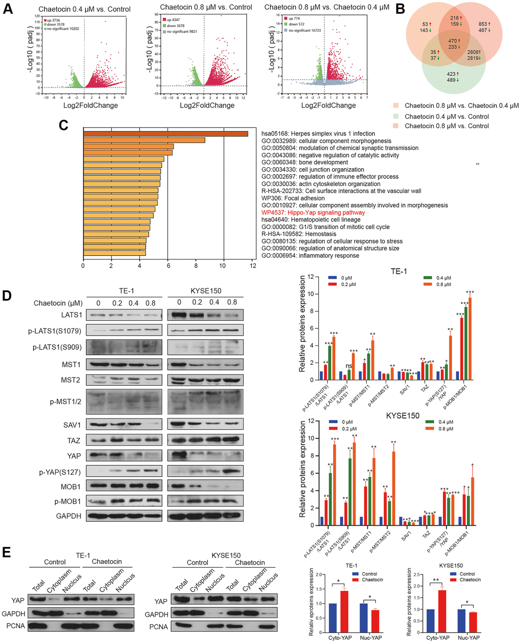 The Hippo pathway is involved in chaetocin-induced ESCC cells apoptosis and anti-proliferation. (A) RNA-seq was performed on non-treated TE-1 cells as well as TE-1 cells with 0.4 μM and 0.8 μM chaetocin treatment for 24 h. Volcano plots were used to analyze transcriptomic data, with the x-axis representing Log2FoldChange (sample/control) values and the y-axis representing the -Log10 (padj). Green, red, and gray circles respectively represent genes that were downregulated, upregulated, and not differentially regulated. (B) Venn diagrams demonstrating the numbers of up- and down-regulated transcripts associated with each treatment. (C) KEGG pathway enrichment analysis of DEGs that were specifically downregulated in the chaetocin treatment. (D) Representative western blot results showing changes in phosphorylation level of proteins in the Hippo pathway, including MST1/2, MOB1, LATS1, SAV1, and YAP, after chaetocin treatment. GAPDH was used as the loading control. (E) Cytosolic and nuclear proteins of TE-1 and KYSE150 cells treated with 0.8 μM chaetocin for 24 h were separated to detect expression levels of YAP. GAPDH and PCNA were used as the loading controls.