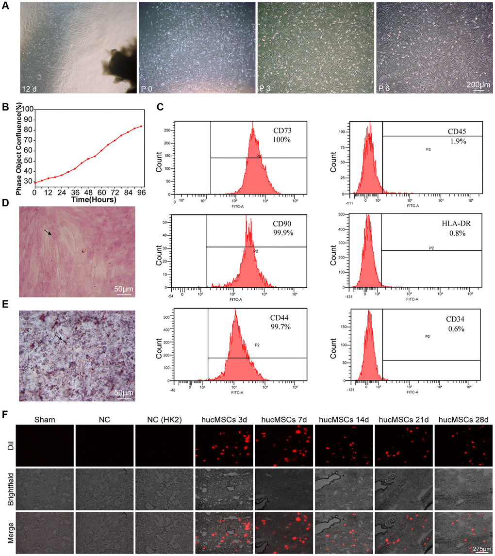 Culture and identification of hucMSCs. (A) Morphological observation of hucMSCs at different times. After 12 days of primary cultivation, cells developed around the tissue block. Zero generation of hucMSCs. Third generation of hucMSCs. Sixth generation of hucMSCs. (B) Growth curve of the third generation of hucMSCs showing their excellent growth as recorded by an IncuCyte S3 instrument. (C) Flow cytometry indicated that the positive rate was 100% for CD73, 99.90% for CD90, and 99.70% for CD44. The positive rate was 0.6% for CD34, 1.9% for CD45, and 0.8% for HLA-DR. (D) After 14 days of osteogenic induction, a positive reaction was noted between calcium nodus alizarin red stain and the osteogenic inducer. (E) After 28 days of adipogenic induction, fat droplets of verified size were positive for oil red O staining. (F) Images of cell membrane fluorescent probe revealing that hucMSCs were retained in the lungs. Mice injected with serum-free medium were used as sham. Mice injected with hucMSCs without fluorescent labeling were used as NC-1 to prove the absence of biological autofluorescence. Mice injected with human kidney 2 (HK-2) cells with labeled fluorescence were used as NC-2 to prove the absence of fluorescence dye leakage.