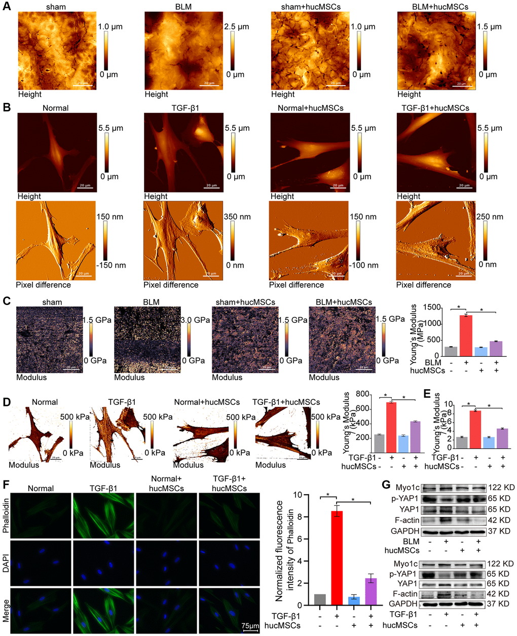 hucMSCs treatment weakened mechanical stiffness in pulmonary fibrosis. (A) AFM images showed that the surface of lung tissues was smooth in the sham group. BLM caused the lung surface to become rough and increased the lung tissue thickness. hucMSCs treatment improved lung tissue morphology. (B) AFM images displayed that the cells were spindle shaped with smooth surface in the normal group. After TGF-β1 stimulation, the cells became elongated and flat and their cell height/roughness increased. hucMSCs treatment improved the cell state. Stress fibers arranged in parallel along the main axis of cells were found in the TGF-β1 group. After hucMSCs intervention, these fibers were reduced. (C) Young’s modulus value increased in the BLM group compared with that in the sham group, and hucMSCs treatment decreased the Young’s modulus. The average Young’s modulus was 299.017 ± 21.021 MPa in the sham group, 1275.667±89.502 MPa in the BLM group, 284.667 ± 18.778 MPa in the sham+hucMSCs group, and 471.183 ± 29.462 MPa in the BLM+hucMSCs group. (D) Young’s modulus increased in the TGF-β1 group compared with that in the normal group, and hucMSCs treatment decreased the Young’s modulus. The average Young's modulus was 254.583 KPa in the normal group, 697.217 KPa in the TGF-β1 group, 238.150 KPa in the normal+hucMSCs group, and 434.150 KPa in the TGF-β1+hucMSCs group. (E) Tests using colloid probe with ball stuck pressed cells were conducted to determine the reaction forces of cells based on Young’s modulus. The average Young’s modulus was 2.686 ± 0.349 KPa in the normal group, 8.742 ± 0.422 KPa in the TGF-β1 group, 2.660 ± 0.333 KPa in the normal+hucMSCs group, and 4.623 ± 0.349 KPa in the TGF-β1+hucMSCs group. (F) Cytoskeleton staining with FITC-phalloidin depicted that the cytoskeleton tension was aggravated by TGF-β1 treatment and alleviated by hucMSCs treatment. (G) hucMSCs treatment decreased YAP1, Myo1c, and F-actin expression and increased p-YAP1 expression in BLM-induced mice model and TGF-β1-activated cell model. Each bar represents the mean ± SD; n = 6; *p 