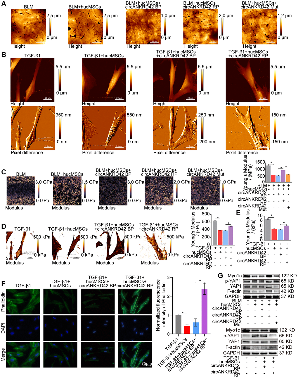 Rescue experiments proved that hucMSCs treatment reduced mechanical stiffness by regulating circANKRD42–miR-136-5p–YAP1 signal pathway in vivo and in vitro. (A) AFM images depicted that BLM caused the roughness of the lung surface and the thickening of the lung tissues. hucMSCs treatment improved the lung tissue morphology, but this therapeutic effect was reversed by overexpressed circANKRD42. The effect of circANKRD42 mutation was weaker than that of overexpressed circANKRD42. (B) In the TGF-β1 group, the cells became slender and flat. Stress fibers arranged in parallel along the main axis of cells were observed in the group. In the hucMSCs-treated group, the cell shape significantly retracted and the corresponding fibers were reduced. Overexpressed circANKRD42 reversed the effect of hucMSCs treatment on cells. (C) Young’s modulus measurement showed that hucMSCs treatment decreased the force compared with that in the BLM group, but overexpressed circANKRD42 reversed the effect of hucMSCs treatment on the force. The effect of circANKRD42 mutation on the force was weaker than that of overexpressed circANKRD42. The measured average Young’s modulus was 1291.667 ± 82.735 MPa in the BLM group, 563.833 ± 31.822 MPa in the BLM+hucMSCs group, 520 ± 20.460 MPa in the BLM+hucMSCs+circANKRD42 BP group, 942.05 ± 28.203 MPa in the BLM+hucMSCs+circANKRD42 RP group, and 604.233 ± 29.259 MPa in BLM+hucMSCs+circANKRD42 Mut. (D) Young’s modulus measurement revealed that hucMSCs treatment decreased the force compared with that in the TGF-β1 group, but overexpressed circANKRD42 reversed the effect of hucMSCs treatment on the force. The measured average Young's modulus was 641.167 KPa in the TGF-β1 group, 389.467 KPa in the TGF-β1+hucMSCs group, 382.767 in the TGF-β1+hucMSCs+circANKRD42 BP group, and 495.433 KPa in TGF-β1+hucMSCs+circANKRD42 RP. (E) Young’s modulus measurement showed that hucMSCs treatment decreased the reaction forces of cells compared with that in the TGF-β1 group, but overexpressed circANKRD42 reversed the effect of hucMSCs treatment on the force. The measured average Young's modulus was 8.858 ± 0.526 KPa in the TGF-β1 group, 4.756 ± 0.306 KPa in the TGF-β1+hucMSCs group, 4.504 ± 0.160 KPa in the TGF-β1+hucMSCs+circANKRD42 BP group, and 6.092±0.240 KPa in TGF-β1+hucMSCs+circANKRD42 RP. (F) Cytoskeleton staining with FITC-phalloidin depicted that cytoskeleton tension was weakened by hucMSCs treatment but enhanced by circANKRD42 overexpression. (G) hucMSCs treatment inhibited the expression levels of YAP1, Myo1c, and F-actin and increased p-YAP1 expression in vivo and in vitro. circANKRD42 overexpression increased the expression of YAP1, Myo1c, and F-actin and decreased p-YAP1 expression, thus reversing the effect of hucMSCs treatment in vivo and in vitro. The effect of circANKRD42 mutation was weaker than that of overexpressed circANKRD42. Each bar represents the mean ± SD; n = 6; *p 