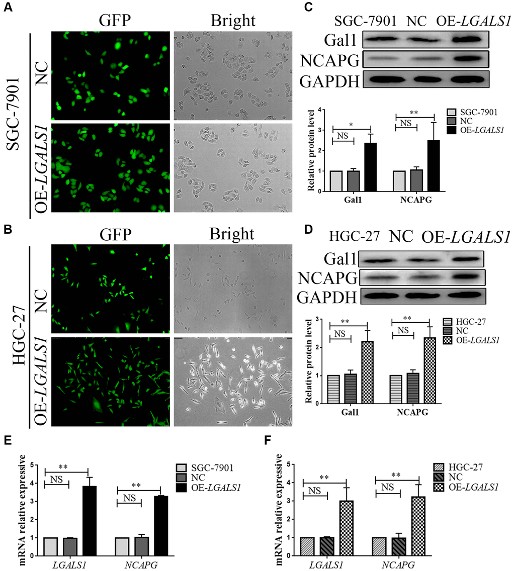 LGALS1 regulates NCAPG at the mRNA and protein levels. Transduction efficiency confirmed by green fluorescent protein (GFP) assay in (A) SGC-7901 cells and (B) HGC-27 cells. Original magnification 100×. (C, D) Western blot confirmation of stable overexpression of Gal1 and NCAPG in (C) SGC-7901 and (D) HGC-27 cells when LGALS1 was overexpressed. (E, F) Quantitative real-time PCR (qRT-PCR) analysis of LGALS1 and NCAPG expression in (E) SGC-7901 and (F) HGC-27 cells when LGALS1 was overexpressed. Abbreviations: OE-LGALS1: Overexpression of LGALS1; NC: negative control (empty vector); NS: not significant. *P **P 