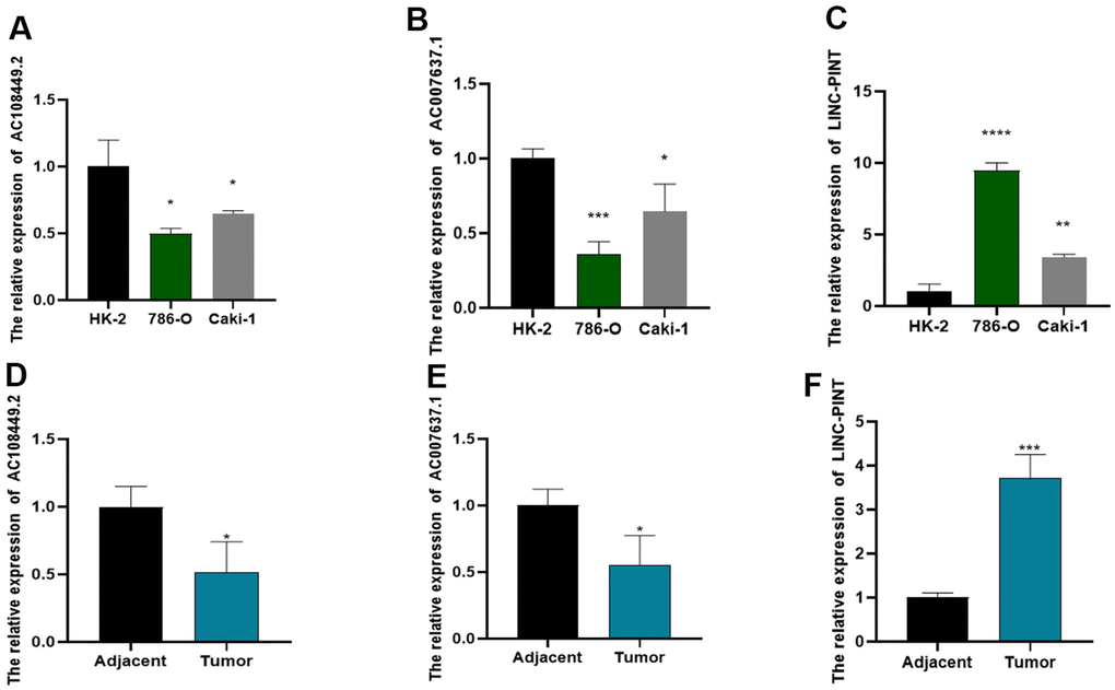 The expression levels of LINC-PINT, AC108449.2 and AC007637.1 in cell lines and ccRCC clinical samples. AC108449.2 (A) and AC007637.1 (B) expressed higher in HK-2 cell than that in ccRCC cell lines. The expression of LINC-PINT enhanced in ccRCC cell lines (C). The expression of AC108449.2 (D) and AC007637.1 (E) were increased in normal kidney tissues, while LINC-PINT (F) was up-regulated in ccRCC tissues.