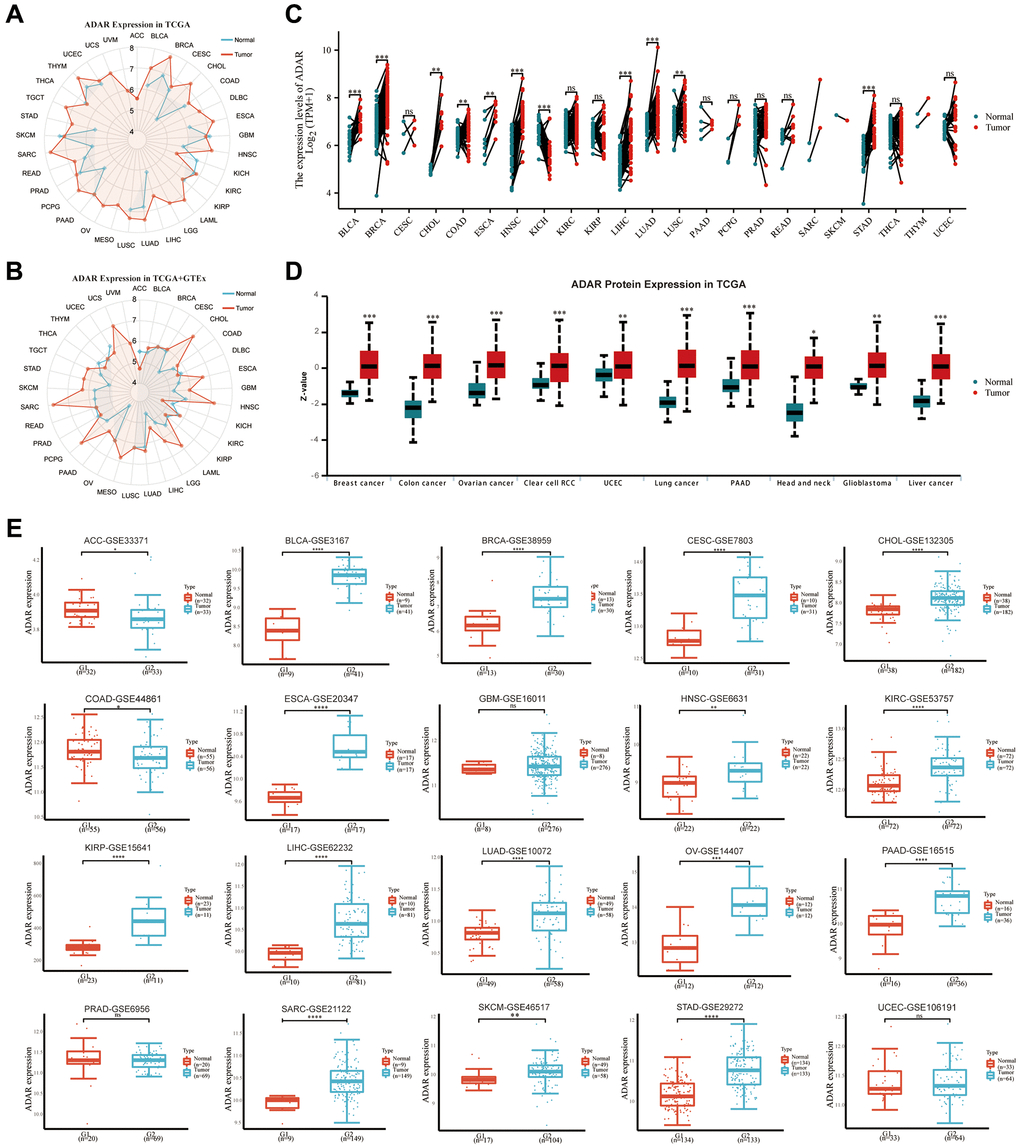 ADAR is upregulated in most cancers. (A) ADAR expression of pan-cancer in TCGA database. (B) ADAR expression of pan-cancer in TCGA database combined with GTEx database. (C) Pairing difference analysis of ADAR in TCGA database. (D) ADAR protein levels are significantly elevated in a variety of cancers. (E) ADAR expression of pan-cancer in GEO database.