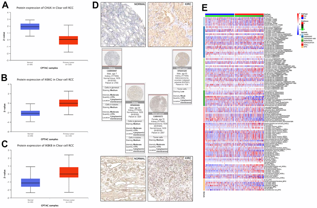 (A–C) Link between the NF-κB-related genes and KIRC was confirmed at the protein level. (D) Immunohistochemical comparison of IKBKG and IKBKB. (E) Based on different algorithms, showing the heat map of the response of immune cells in the high- and low-risk groups. Red and blue represent high and low infiltration levels, respectively, and different algorithms are represented by different colored area bars.