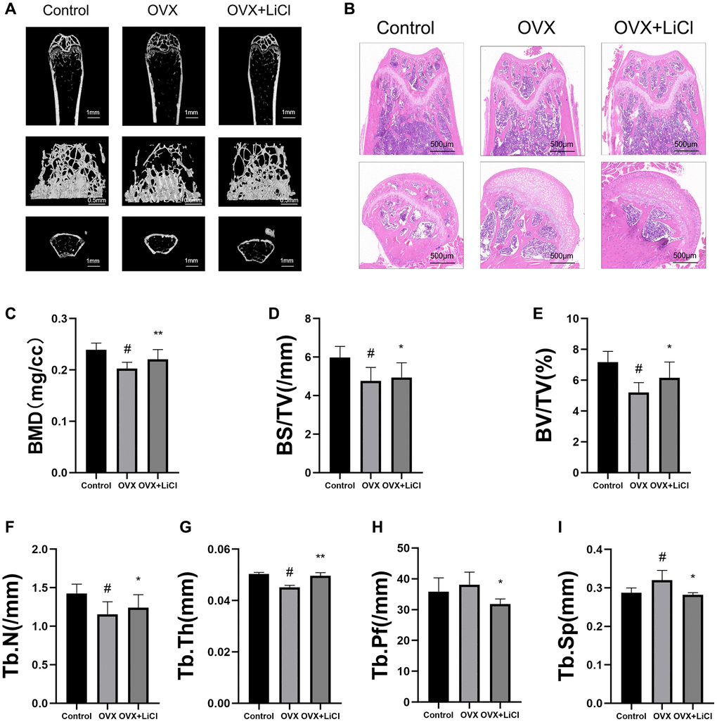 LiCl reverses bone loss in OVX mice. (A) Representative 3D micro-CT images of distal femurs from three groups (Sham surgery groups, OVX groups, OVX+LiCl-treated groups) were performed after eight-week surgery. (B) H&E staining was performed for evaluating the trabecular bone of distal femurs from each group. (C–I) Corresponding parameters showing the treatment of osteoporosis by LiCl therapy. Abbreviations: BV/TV: bone volume/tissue volume; Tb.N: trabecular number; Tb.Sp: trabecular spacing; BMD: bone mass density; Tb.Th: trabecular thickness; BS/BV: bone surface area/bone volume; Tb.PF: trabecular pattern factor. n = 6. All results are performed as mean ± SD. #P *P **P 