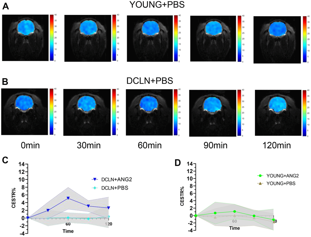 Angiopep-2 CEST MRI results. (A, B) Representative images for YOUNG and DCLN rats injected with PBS. (C) Comparison of YOUNG rats injected with ANG2 and PBS (n=5). (D) Comparison of DCLN rats injected with ANG2 and PBS (n=5).